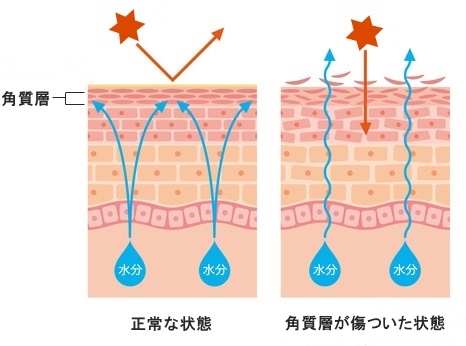 髭剃り後のヒリヒリって何 髭剃りの肌荒れ原因とは カミソリ負けに悩む男性へおすすめのスキンケア Lifeport